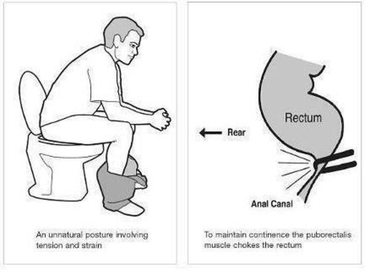 Warum können Männer und Mädchen nicht lange auf der Toilette sitzen: Ist es schädlich oder ist es manchmal möglich?