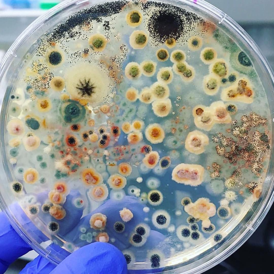 Wissenschaftler haben festgestellt, wo sich die meisten Mikroben auf dem Körper und in der Umgebung eines Menschen befinden - ein Leben ohne Krankheiten und Medikamente