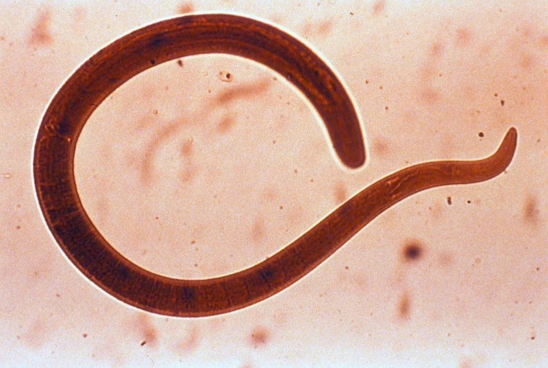 9 stiltiende tegn på, at der bor parasitter i dig